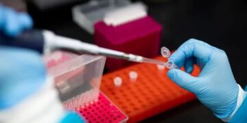 Sanofi compra Blueprint: O maior investimento em imunologia