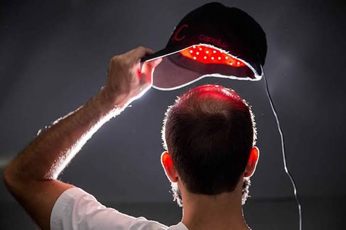 Capacete de LED: vale a pena investir nessa nova solução contra a calvície?